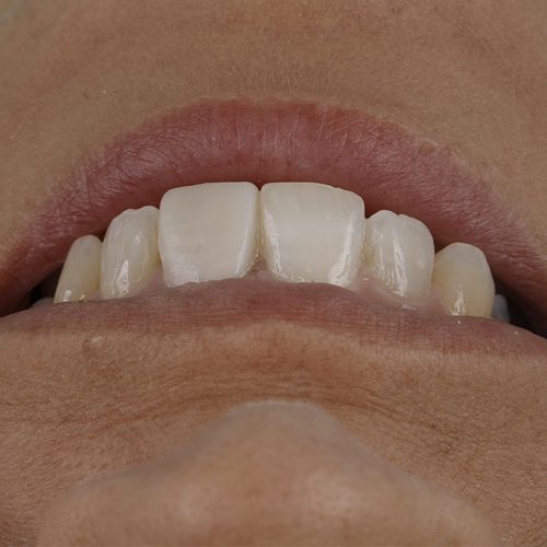 Estética Dental y Facial