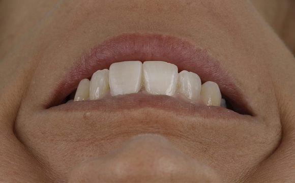 Estética Dental y Facial